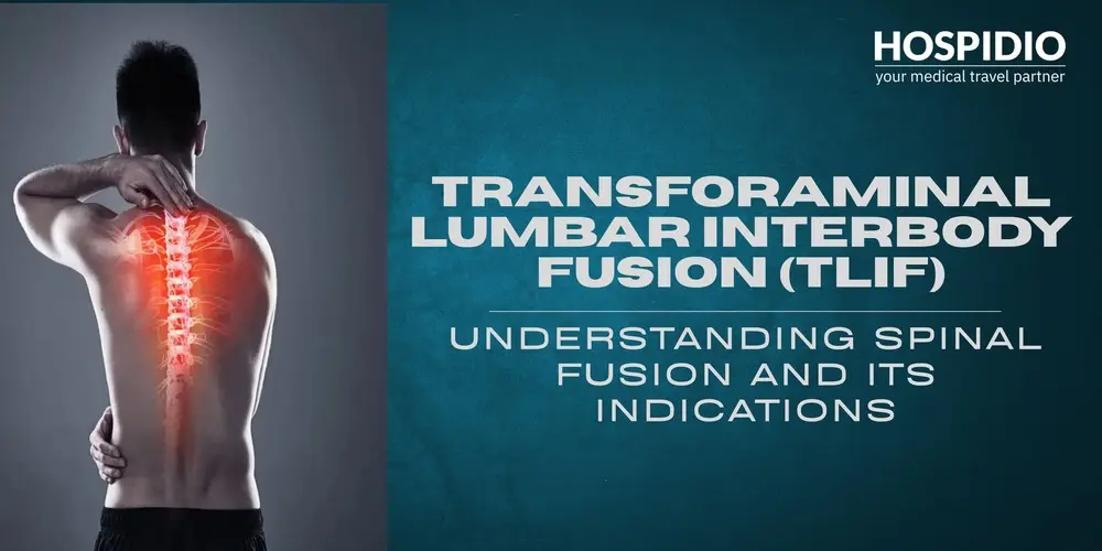 Transforaminal Lumbar Interbody Fusion (TLIF): Understanding Spinal Fusion and Its Indications