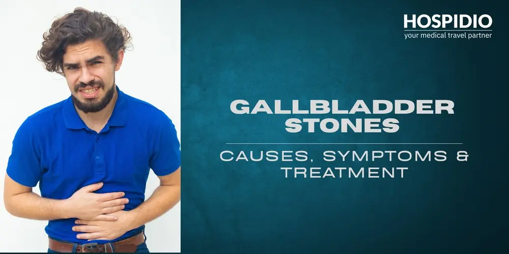 Gallbladder Stones Explained: A Comprehensive Overview