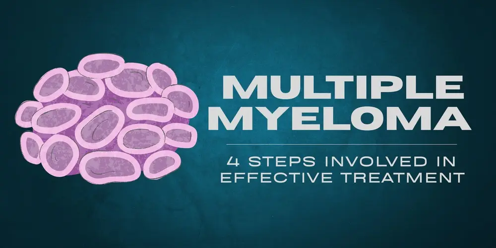 4 Steps Involved In Multiple Myeloma Treatment