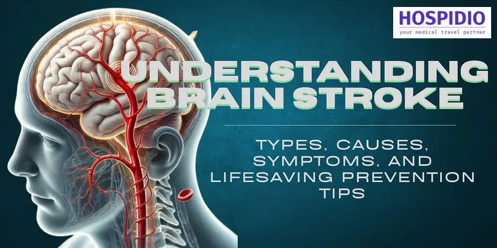 Understanding Brain Stroke Types, Causes, Symptoms and Lifesaving Prevention Tips