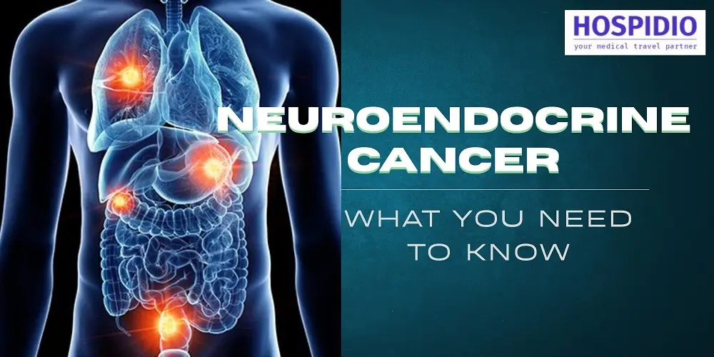 Neuroendocrine Tumors: Causes, Diagnosis, and Treatment