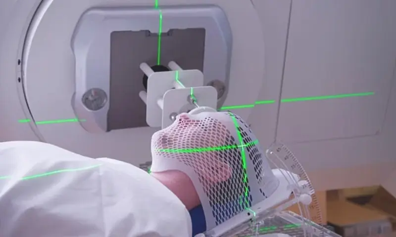 Brachytherapy Treatment 